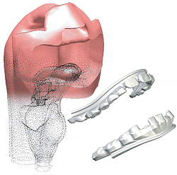 airway_teeth_scan